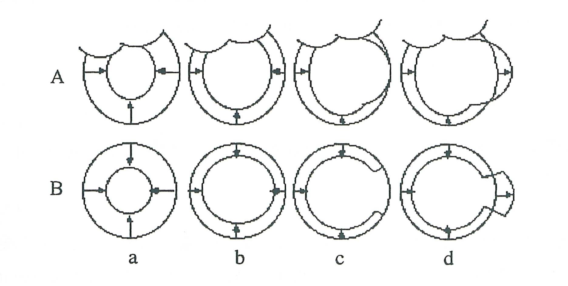 Beispiele für die linksventrikuläre Motilität (A) und ihre Simulation durch das Herzphantom (B).